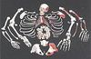 Squelette humain démonté avec représentation des muscles