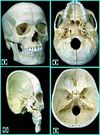 Crâne en résine avec structures osseuses