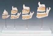 Développement de la dentition en 4 stades