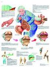 Planche anatomique : l'arthrose  50x67 cm version française