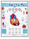 Planche anatomique : l'infartus du myocarde 50x67 cm version française