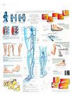 Planche anatomique : varices, varicosités 50x67 cm version française