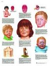 Planche anatomique : maladies infantiles 50x67cm français
